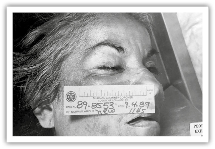 A photo from the autopsy of Guadalupe Apodaca. A tape measure is held up to a woman's face.